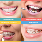Invisible Braces and Orthodontics