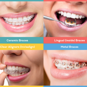 Invisible Braces and Orthodontics