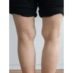 Deformity correction services