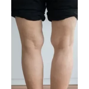 Deformity correction services