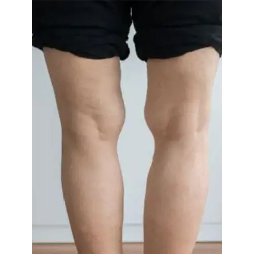 Deformity correction services