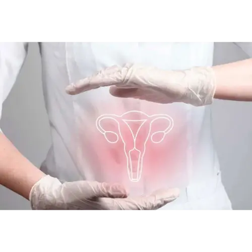 Endometriosis