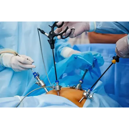 Laparoscopy