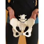 Pelvic-acetabular surgery
