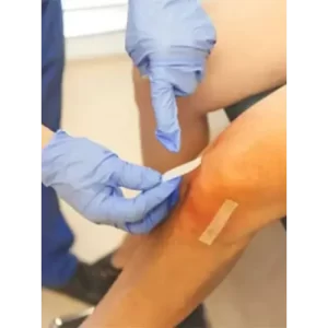 Arthroscopic ligament reconstruction