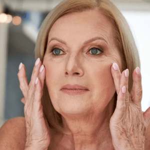 Age Spots Treatment in Noida