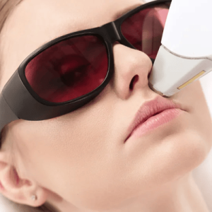 Blueberry Phoenix Laser Treatment