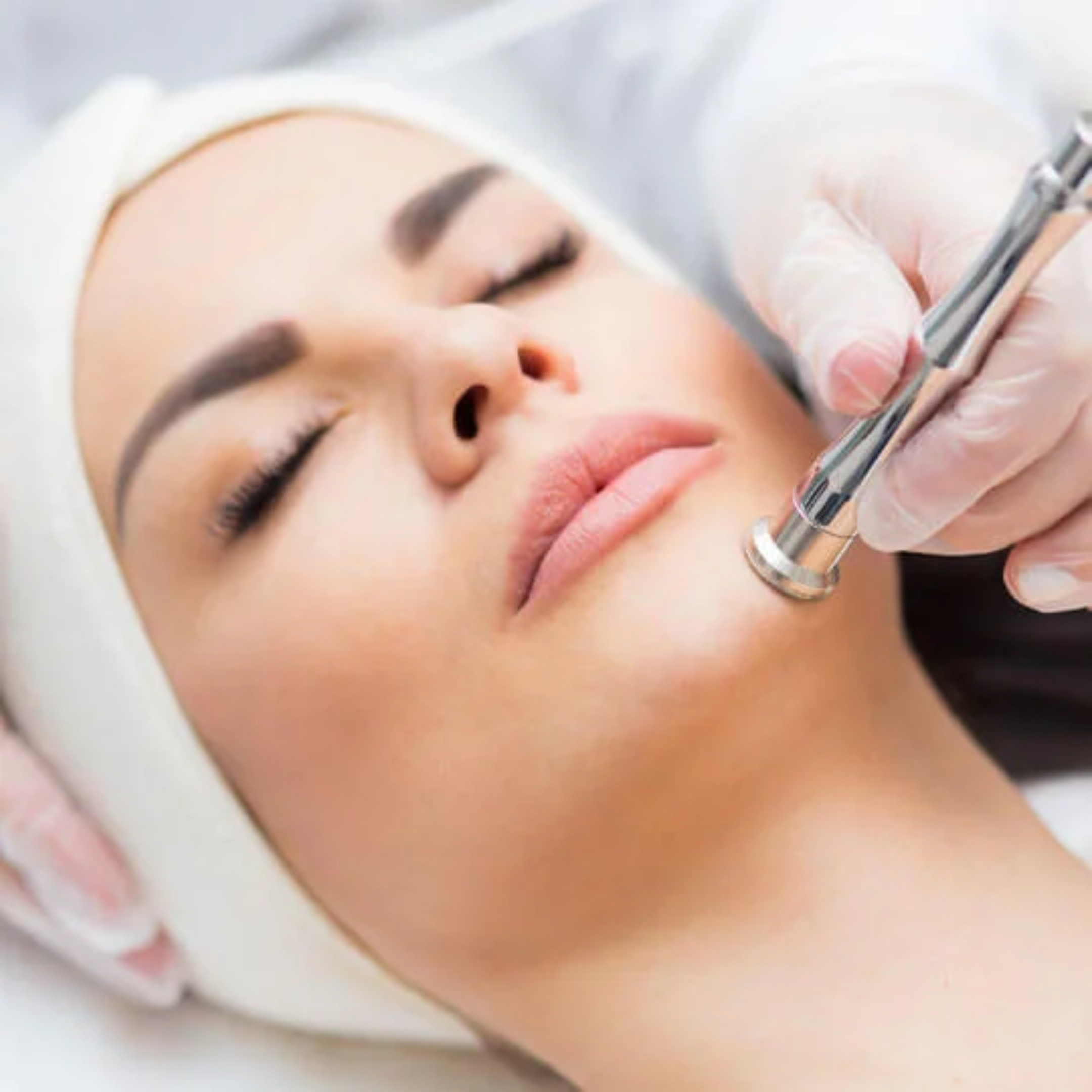 Microdermabrasion