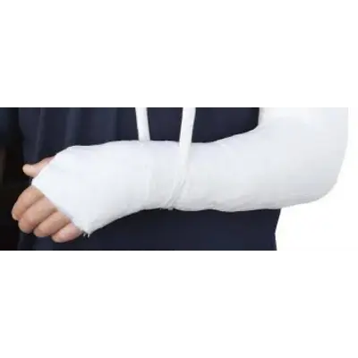 Fracture Management