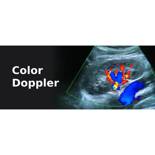Color Doppler