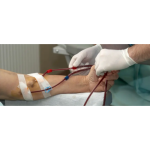 dialysis