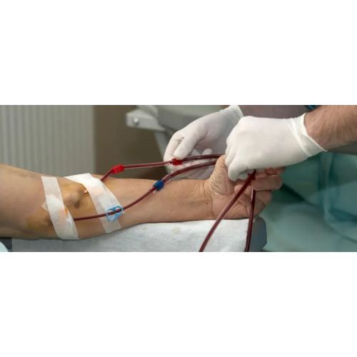 dialysis