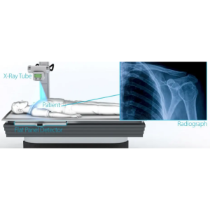 digital-xray