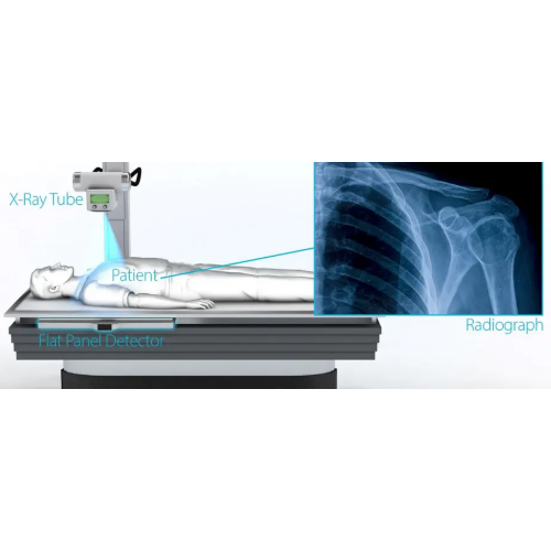 digital-xray