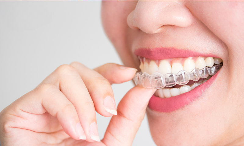 Untitled design (3) Implant Dentistry