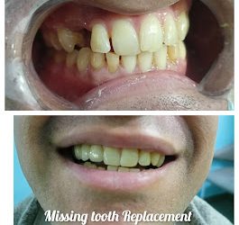 Centre of Dental Excellence – Best Dental in Delhi