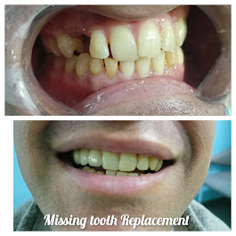 Best dental clinic in Delhi