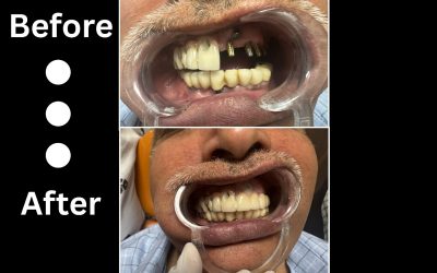 Top Dental Care in the Capital – Best Dentist in Delhi for Advanced & Comfortable Treatments