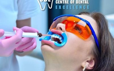 Teeth Whitening Clinic in South Delhi for a Brighter and Confident Smile