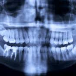 Digital Dental X-Ray