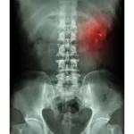 xray