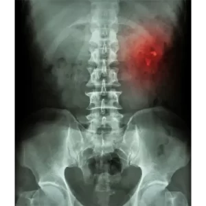 xray