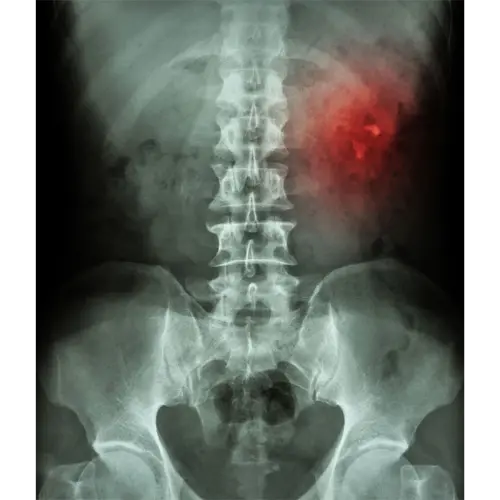 xray