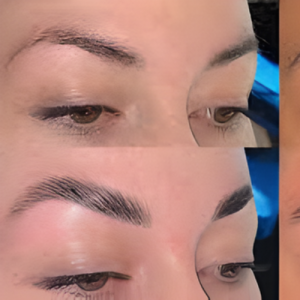 Brows Treatment