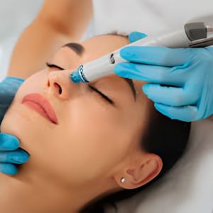 Pelleve Skin Tightening