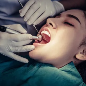 Root Canal Treatment